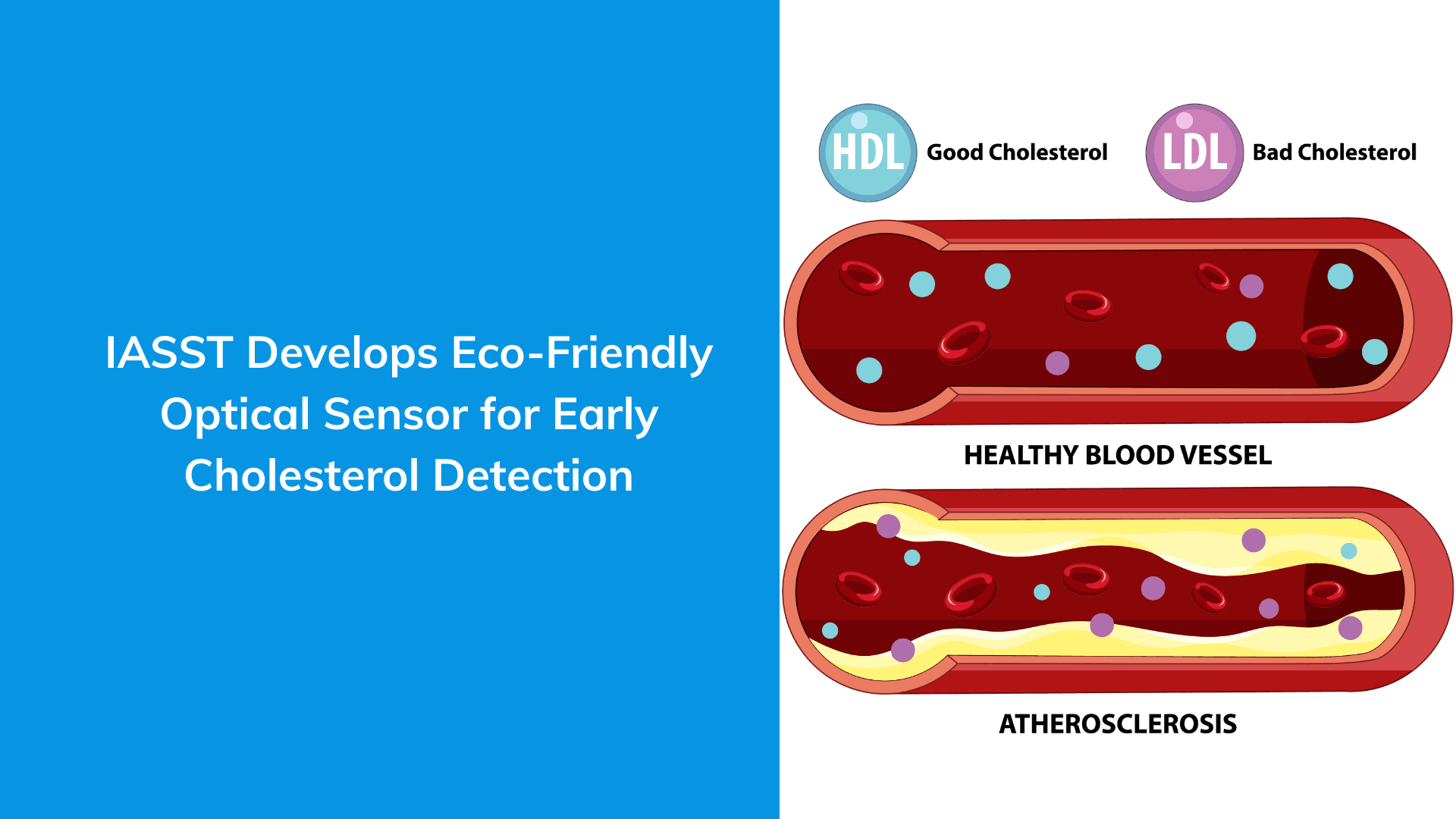 IASST Develops Eco-Friendly Optical Sensor for Early Cholesterol Detection  | Optical Sensor | Early Cholesterol | Detection | Voiceofhealthcare